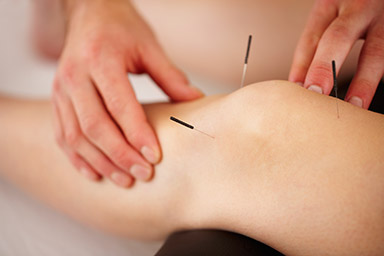 acupuncture on the knee